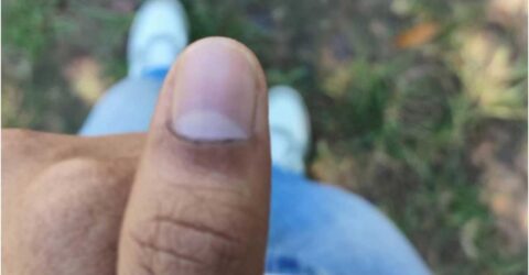 চাকসু নির্বাচনে কালি মুছে যাওয়ার অভিযোগ – ছাত্রদল জানায় অভিযোগ দেবে