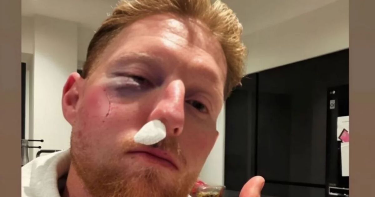 বলের আঘাতে গুরুতর চোটের কবলে বেন স্টোকস