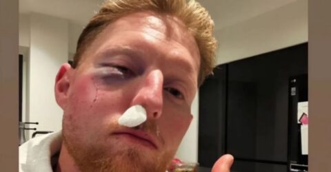 বলের আঘাতে গুরুতর চোটের কবলে বেন স্টোকস